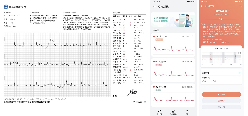 评估华为品质整体手机的方法_如何评估华为手机的整体品质？_华为手机如何评估手机价格
